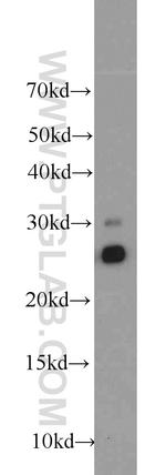 TPK1 Antibody in Western Blot (WB)