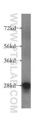 TPK1 Antibody in Western Blot (WB)
