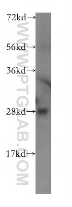 TPK1 Antibody in Western Blot (WB)