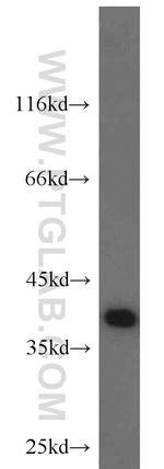 SUMO2/3 Antibody in Western Blot (WB)