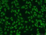 SUMO2/3 Antibody in Immunocytochemistry (ICC/IF)