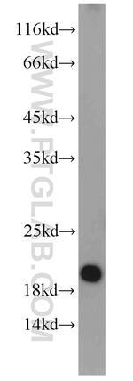 SUMO2/3 Antibody in Western Blot (WB)