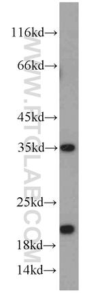 SUB1 Antibody in Western Blot (WB)