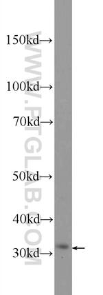 CTDSP1 Antibody in Western Blot (WB)
