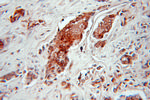 HMGN2 Antibody in Immunohistochemistry (Paraffin) (IHC (P))