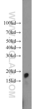 HMGN2 Antibody in Western Blot (WB)
