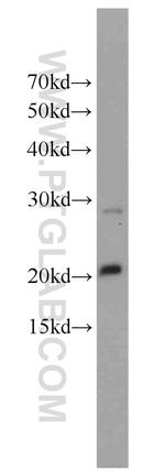 HMGN2 Antibody in Western Blot (WB)