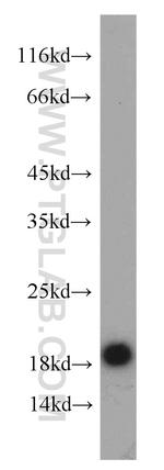 HMGN2 Antibody in Western Blot (WB)