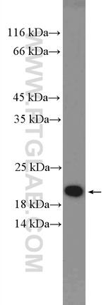 HMGN2 Antibody in Western Blot (WB)