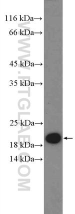 HMGN2 Antibody in Western Blot (WB)