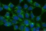 Galectin 8 Antibody in Immunocytochemistry (ICC/IF)