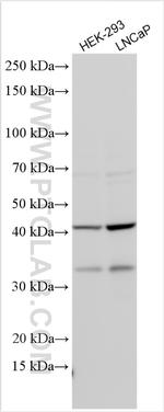 Galectin 8 Antibody in Western Blot (WB)