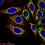 FIS1 Antibody in Immunocytochemistry (ICC/IF)