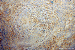 Cofilin Antibody in Immunohistochemistry (Paraffin) (IHC (P))