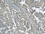 Cofilin Antibody in Immunohistochemistry (Paraffin) (IHC (P))