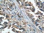 Cofilin Antibody in Immunohistochemistry (Paraffin) (IHC (P))