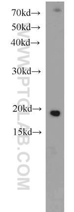 Cofilin Antibody in Western Blot (WB)