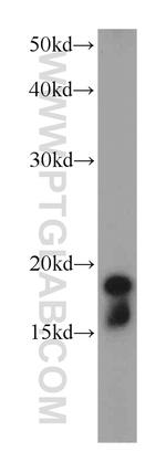 Cofilin Antibody in Western Blot (WB)