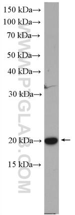 Cofilin Antibody in Western Blot (WB)