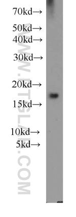 Cofilin Antibody in Western Blot (WB)