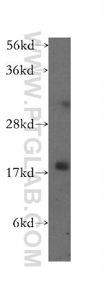 Cofilin Antibody in Western Blot (WB)