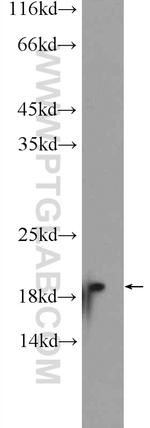 Cofilin Antibody in Western Blot (WB)