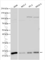 Destrin Antibody in Western Blot (WB)