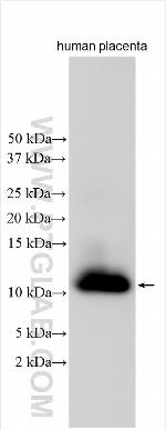 LSM2 Antibody in Western Blot (WB)