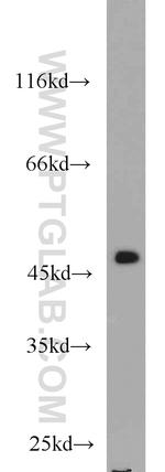 FH Antibody in Western Blot (WB)