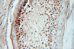 Coilin Antibody in Immunohistochemistry (Paraffin) (IHC (P))