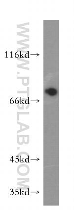 PABPC1/PABP Antibody in Western Blot (WB)