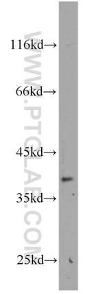 MAB21L2 Antibody in Western Blot (WB)