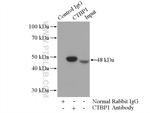 CTBP1 Antibody in Immunoprecipitation (IP)