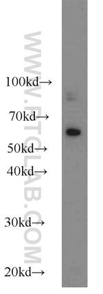 KLRG1 Antibody in Western Blot (WB)