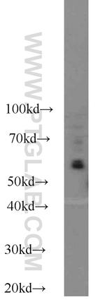 KLRG1 Antibody in Western Blot (WB)