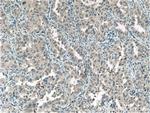 STXBP6 Antibody in Immunohistochemistry (Paraffin) (IHC (P))