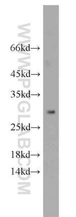 STXBP6 Antibody in Western Blot (WB)