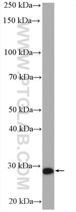 STXBP6 Antibody in Western Blot (WB)