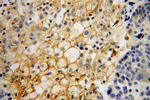 HSD17B2 Antibody in Immunohistochemistry (Paraffin) (IHC (P))