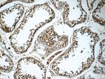 CUL2 Antibody in Immunohistochemistry (Paraffin) (IHC (P))