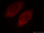 CUL2 Antibody in Immunocytochemistry (ICC/IF)