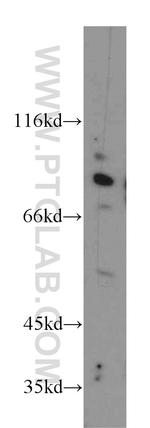 CUL2 Antibody in Western Blot (WB)