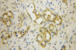 NCLN Antibody in Immunohistochemistry (Paraffin) (IHC (P))