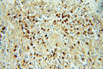 GRIM19 Antibody in Immunohistochemistry (Paraffin) (IHC (P))