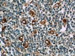 WASP Antibody in Immunohistochemistry (Paraffin) (IHC (P))