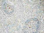 WASP Antibody in Immunohistochemistry (Paraffin) (IHC (P))