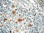 WASP Antibody in Immunohistochemistry (Paraffin) (IHC (P))
