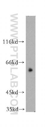WASP Antibody in Western Blot (WB)