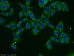 VILIP 3 Antibody in Immunocytochemistry (ICC/IF)