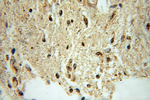 VILIP 3 Antibody in Immunohistochemistry (Paraffin) (IHC (P))